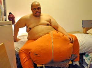 TLC to air 'The Man with the 132-Pound Scrotum" Monday, August 19 at 9 p.m.